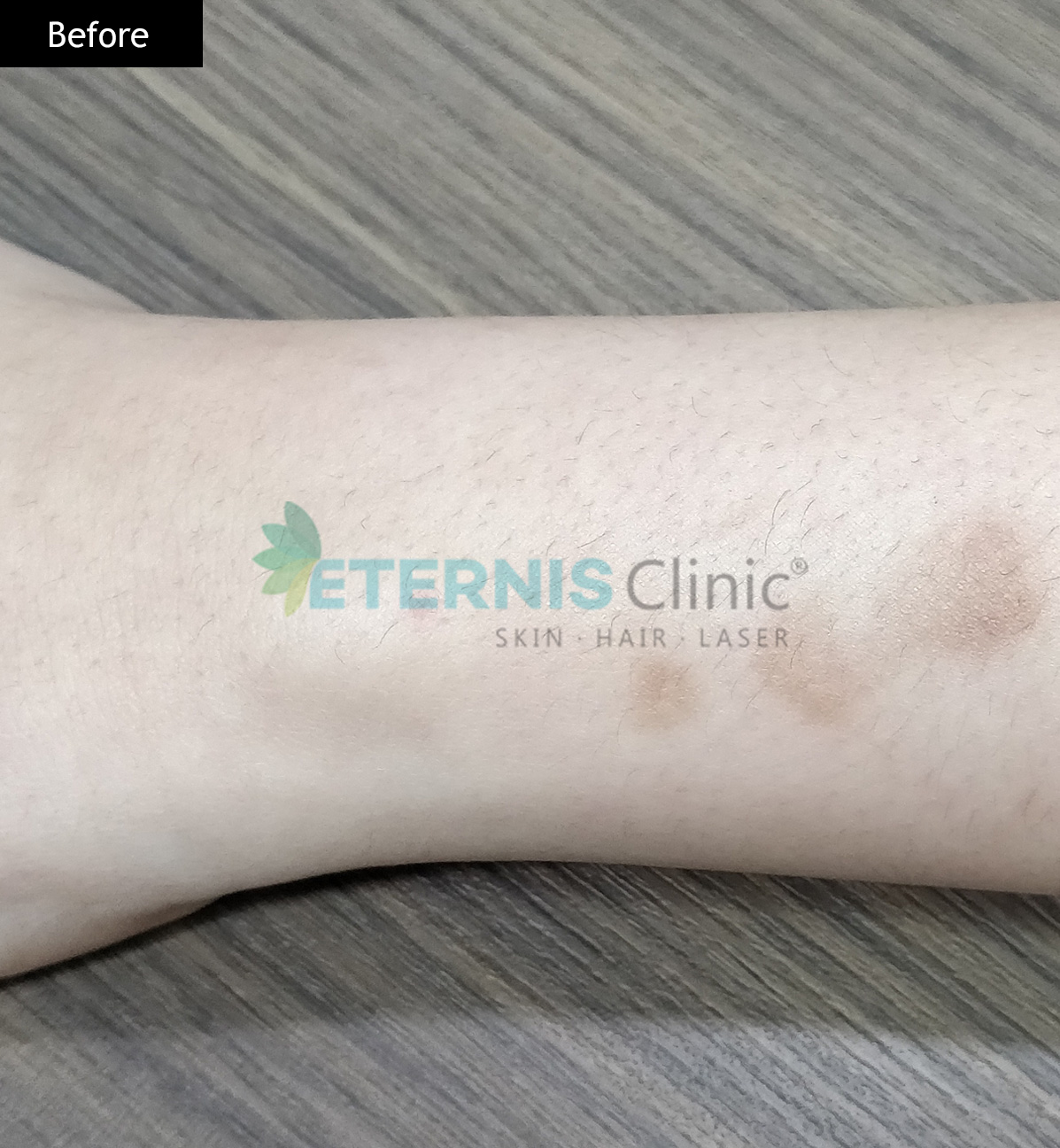 Before: Burn scar revision