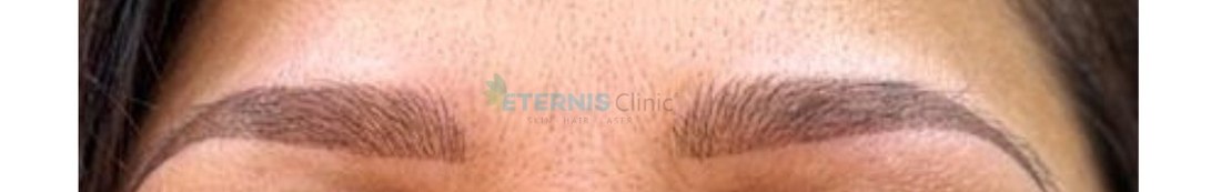After: Nano-brow restoration, sparse to defined