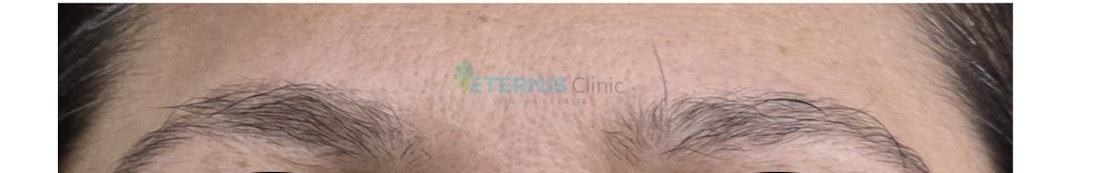 Before: Nano-brow restoration, sparse to defined