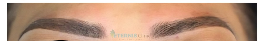 After: Nano-brow restoration, natural arch definition