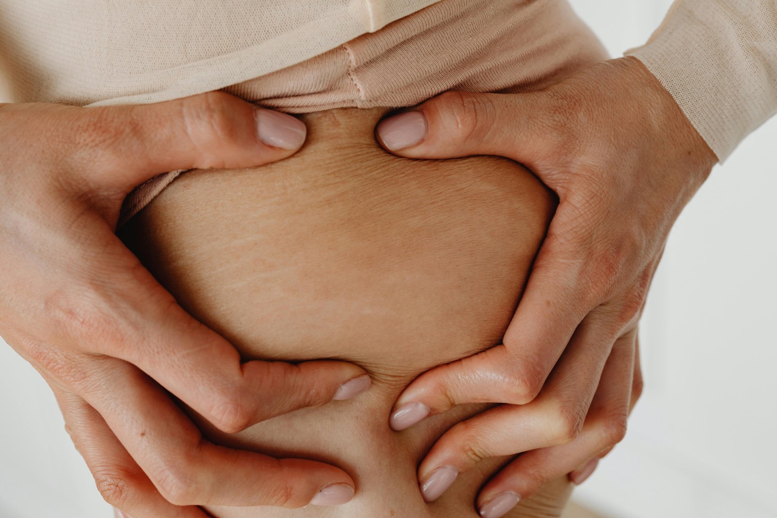 Stretch Marks Treatment