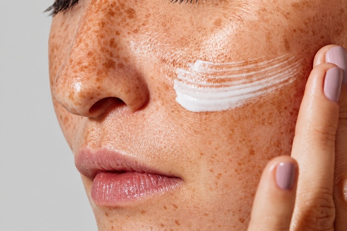 Pigmentation Treatment in Pune at Eternis Skin Clinic