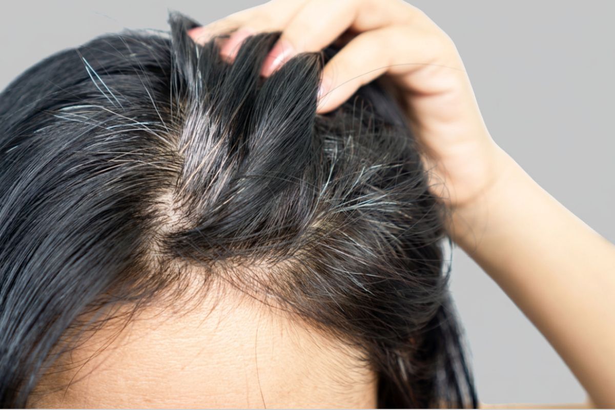 Premature Gray Hair Treatment in Pune at Eternis Skin Clinic