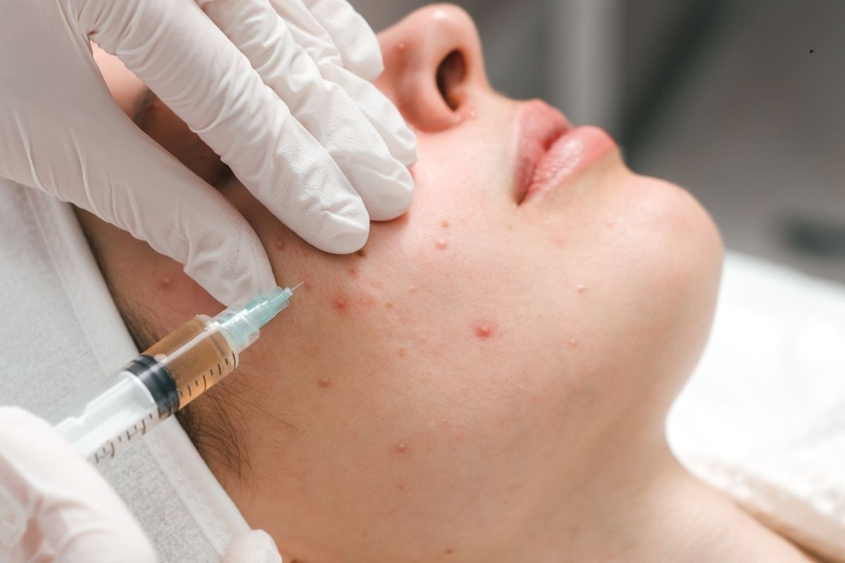 Intralesional Therapy in Pune at Eternis Skin Clinic